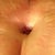 PO day 1 belly button