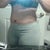 6 weeks PO revision. Sorry for the dirty mirror!
