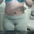 6 weeks PO revision. My left side is still more swollen than the right. I need a better compression garment that sucks in the sides more. This was taken at the end of the day so I may have been alittle swollen.