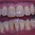 1-2-2013 Tray 22/24