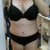 Day 12, 2 pounds less than presurgery weight!  Still very swollen.