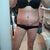 Incision looks good. When is this tape going to come off?  The upper line on my belly is where my binder is rubbing on me. I put a tshirt on again tonight to help!