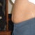 Pre-op Side view