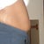 Pre-op side view
