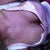 1 day post op boobies