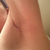 day 25 left incision