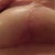 under view right breast 4wks