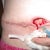 6 week post-op open wound