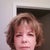 Just got up and am getting ready for first day back to work - still have a little swelling and redness which is covered by make-up (1/23/12)