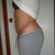 3 weeks post revision on the right side (left view)