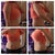 7 days pre-op. chubby arms and especially chunky mid section. Getting cellulite which was never a problem for me before gaining weight.