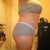 8 month's post pot as you can see my open wound has closed up and healed and in 2 months i get to go in for my SRS woo hoo