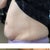Side view of tummy.