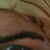 Just under a week after getting the Rejuvi, edges definitely starting to lift. Must. Resist. Temptation. To. Pick! Apparently the longer these ghastly scabs are on my face, the better (more ink it lifts, less chance of scarring etc etc... I just want them gone now!)