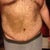 This is about 2 months post op