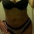 AFTER PIC - front view - 11 weeks post op