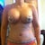 one week after surgery