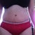 Moles after TT