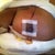 Right breast
