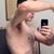 27 days post-op... side view.