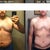 27 days post-op. Comparison to start of 2011.