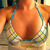 1 Day Post-Op.. Unpadded bikini