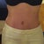 Almost 6 weeks PO. Feeling and looking sexy!