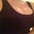 New boobies "breathing" at 5 days post op.