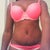 2 mos. scar pic