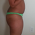 side view