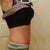 Rt Side..you can see my arm scars in both side pics..not too pretty but getting better