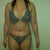4 weeks post op
