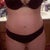 13 days post op from original surgery and 9 days post op from emergency surgery