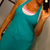 hips slimmer 12 days post-op