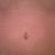 Belly button close up 6 weeks.