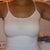 5 weeks - wish i lipo'd my inner thighs!