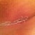 This is my scar with the scar guard on.. it does flake off which is kinda annoying.