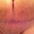 My scar after a shower..she have some scar guard on...I am sure it will all come off someday.