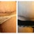 Scar: Week 1 (left) Week 2 (right)