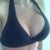 3 wks 3 days post op
