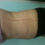 6 wks side view