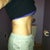 almost 6 1/2 months post op