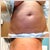 Before and after day 7