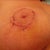 It is only 9 days. I think the incisions look great!