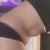 11 weeks post op and I hate this pouch when I either bend over or sit down