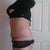 11 weeks po, totally relaxed here so not holding in at all and I hate this pouch above my incision. This photo was taken about 5.30 pm so prob some swelling here.