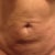 4 weeks,1 day-morning. I am really happy with my results. I have a little extra skin on top of my belly,but the doctor always warned me about this. I still have a long way to go, but I'm happy so far!