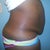 this is my other side view....