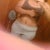 19 po bottom and sides still swollen