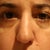 eyes post filler, believe it or not